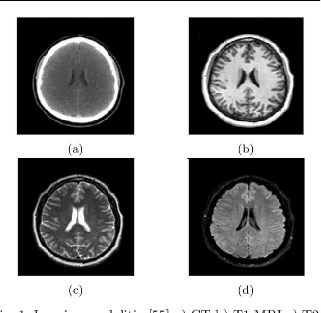 Figure 1 for A Survey and Analysis on Automated Glioma Brain Tumor Segmentation and Overall Patient Survival Prediction