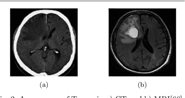 Figure 3 for A Survey and Analysis on Automated Glioma Brain Tumor Segmentation and Overall Patient Survival Prediction