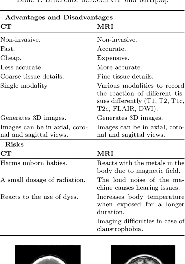 Figure 2 for A Survey and Analysis on Automated Glioma Brain Tumor Segmentation and Overall Patient Survival Prediction