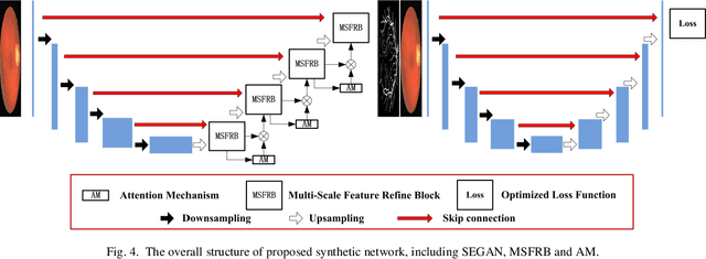 Figure 4 for A Symmetric Equilibrium Generative Adversarial Network with Attention Refine Block for Retinal Vessel Segmentation