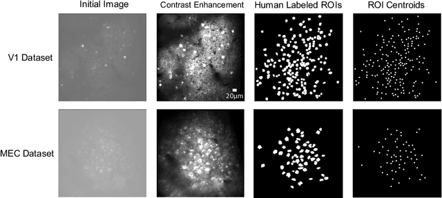 Figure 1 for Automatic Neuron Detection in Calcium Imaging Data Using Convolutional Networks