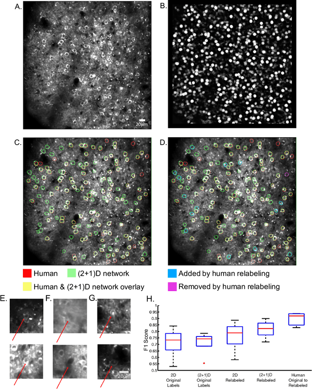 Figure 4 for Automatic Neuron Detection in Calcium Imaging Data Using Convolutional Networks