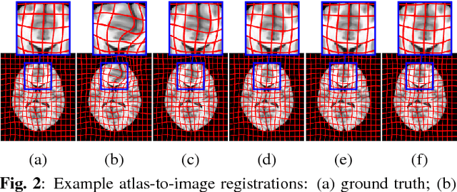 Figure 2 for Efficient Registration of Pathological Images: A Joint PCA/Image-Reconstruction Approach