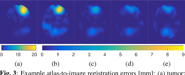Figure 3 for Efficient Registration of Pathological Images: A Joint PCA/Image-Reconstruction Approach
