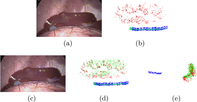 Figure 1 for ORBSLAM-based Endoscope Tracking and 3D Reconstruction