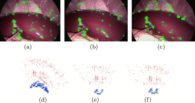 Figure 2 for ORBSLAM-based Endoscope Tracking and 3D Reconstruction