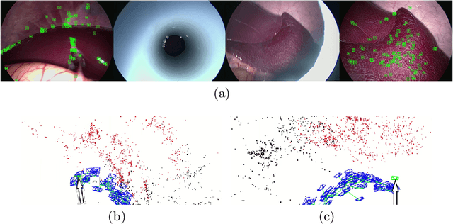 Figure 3 for ORBSLAM-based Endoscope Tracking and 3D Reconstruction