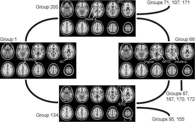 Figure 3 for A Hierarchical Graphical Model for Big Inverse Covariance Estimation with an Application to fMRI