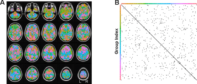 Figure 2 for A Hierarchical Graphical Model for Big Inverse Covariance Estimation with an Application to fMRI