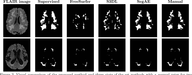 Figure 2 for Unsupervised brain lesion segmentation from MRI using a convolutional autoencoder
