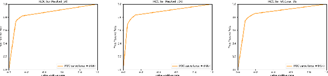 Figure 2 for Classification of Long Noncoding RNA Elements Using Deep Convolutional Neural Networks and Siamese Networks