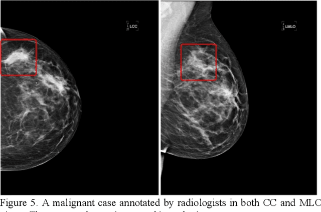 Figure 4 for Applying a random projection algorithm to optimize machine learning model for breast lesion classification