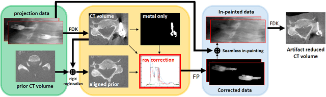 Figure 1 for Metal Artifact Reduction in Cone-Beam X-Ray CT via Ray Profile Correction