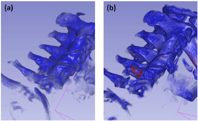 Figure 2 for Metal Artifact Reduction in Cone-Beam X-Ray CT via Ray Profile Correction