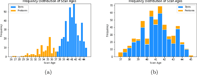 Figure 2 for A Deep Generative Model of Neonatal Cortical Surface Development