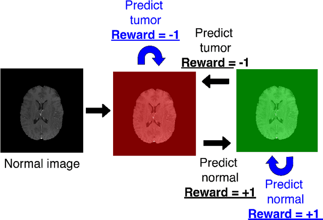 Figure 1 for Deep reinforcement learning-based image classification achieves perfect testing set accuracy for MRI brain tumors with a training set of only 30 images
