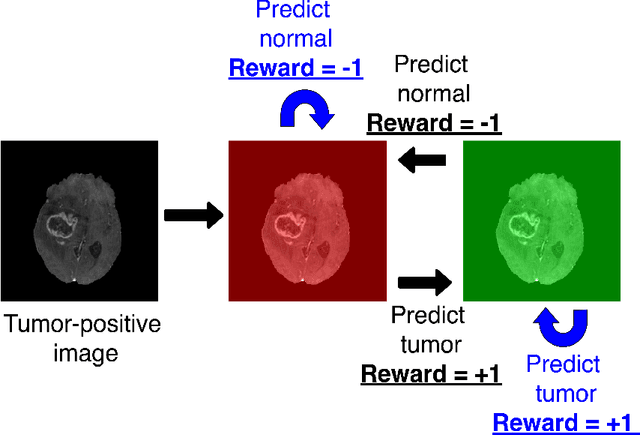 Figure 2 for Deep reinforcement learning-based image classification achieves perfect testing set accuracy for MRI brain tumors with a training set of only 30 images