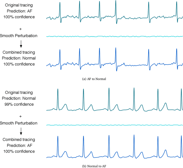 Figure 1 for Adversarial Examples for Electrocardiograms
