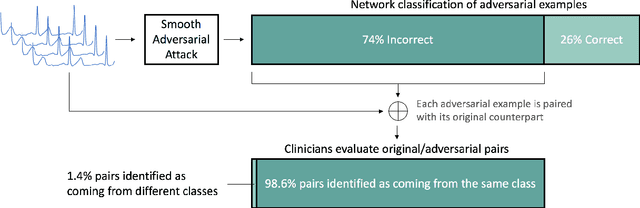 Figure 2 for Adversarial Examples for Electrocardiograms