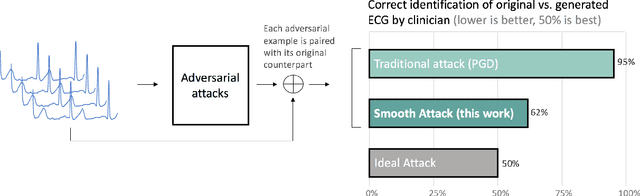 Figure 3 for Adversarial Examples for Electrocardiograms