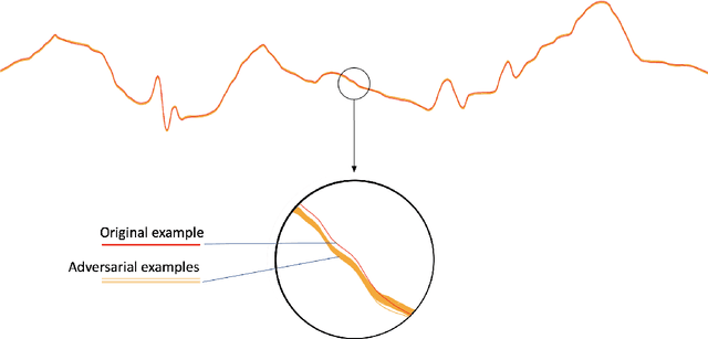 Figure 4 for Adversarial Examples for Electrocardiograms