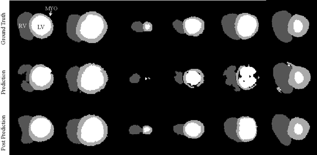 Figure 2 for Cardiac MRI Segmentation with Strong Anatomical Guarantees