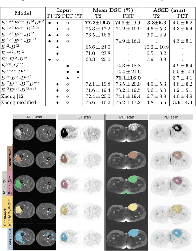 Figure 2 for Soft Tissue Sarcoma Co-Segmentation in Combined MRI and PET/CT Data