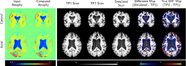 Figure 3 for Distinguishing Healthy Ageing from Dementia: a Biomechanical Simulation of Brain Atrophy using Deep Networks
