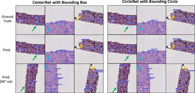 Figure 4 for Circle Representation for Medical Object Detection