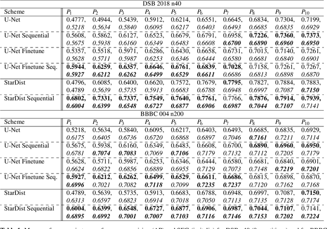Figure 2 for Leveraging Self-supervised Denoising for Image Segmentation