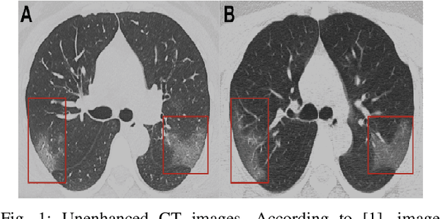 Figure 1 for COVID-CLNet: COVID-19 Detection with Compressive Deep Learning Approaches