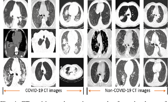 Figure 4 for COVID-CLNet: COVID-19 Detection with Compressive Deep Learning Approaches