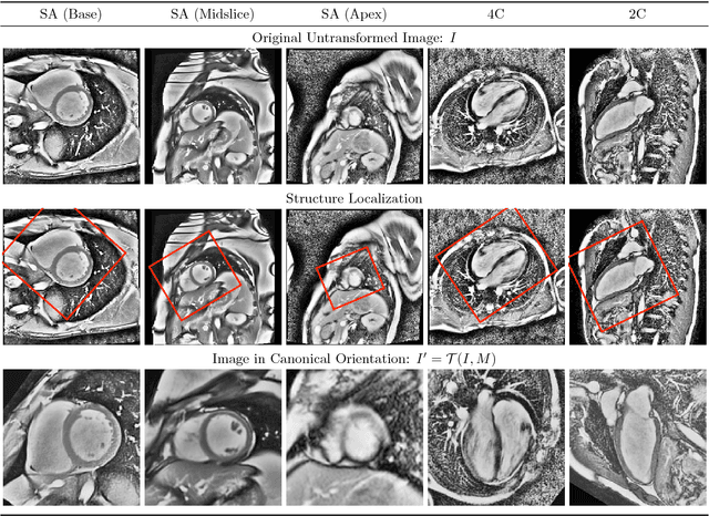 Figure 3 for Ω-Net : Fully Automatic, Multi-View Cardiac MR Detection, Orientation, and Segmentation with Deep Neural Networks