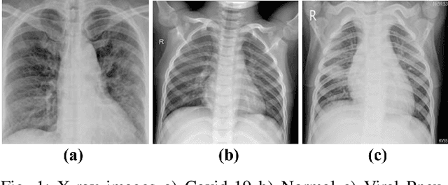 Figure 1 for Detection of Covid-19 Patients with Convolutional Neural Network Based Features on Multi-class X-ray Chest Images