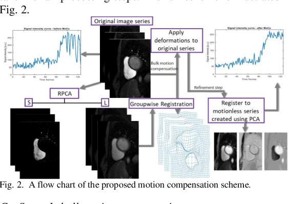 Figure 4 for Automated quantitative analysis of first-pass myocardial perfusion magnetic resonance imaging data