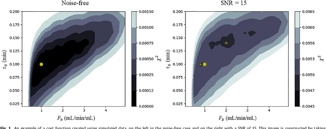 Figure 2 for Automated quantitative analysis of first-pass myocardial perfusion magnetic resonance imaging data