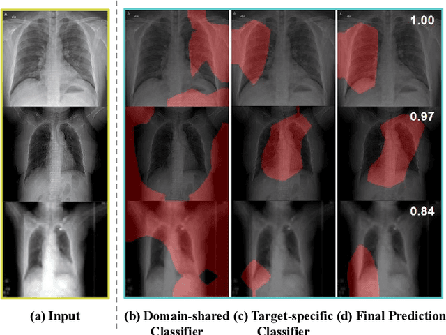 Figure 2 for COVID-DA: Deep Domain Adaptation from Typical Pneumonia to COVID-19