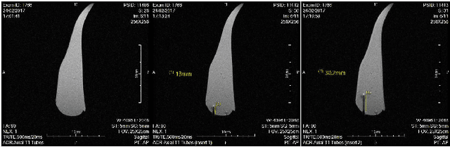 Figure 2 for Can a Tesla Turbine be Utilised as a Non-Magnetic Actuator for MRI-Guided Robotic Interventions?