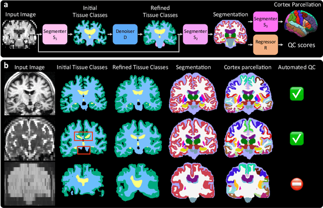 Figure 1 for Robust machine learning segmentation for large-scale analysis of heterogeneous clinical brain MRI datasets
