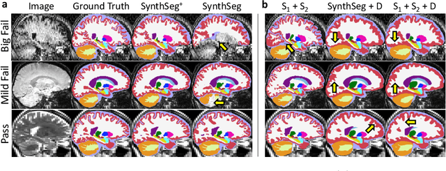 Figure 3 for Robust machine learning segmentation for large-scale analysis of heterogeneous clinical brain MRI datasets