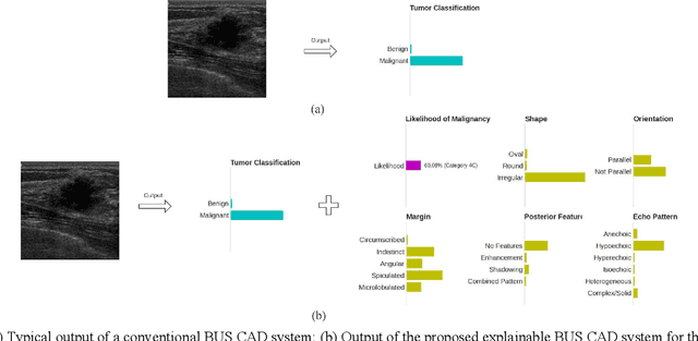 Figure 1 for BI-RADS-Net: An Explainable Multitask Learning Approach for Cancer Diagnosis in Breast Ultrasound Images