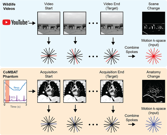 Figure 2 for On Real-time Image Reconstruction with Neural Networks for MRI-guided Radiotherapy