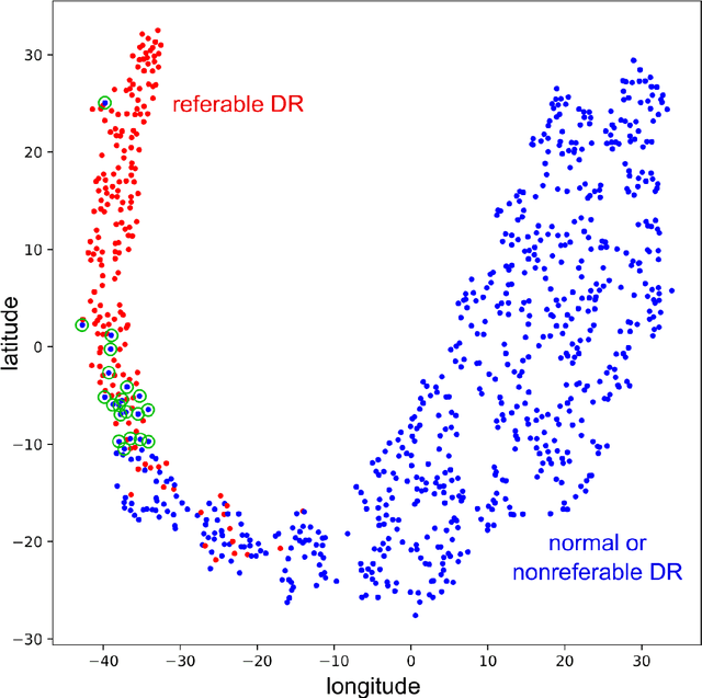 Figure 3 for Instant automatic diagnosis of diabetic retinopathy