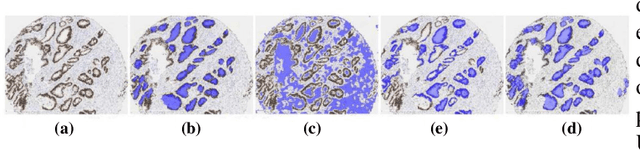 Figure 4 for A Comprehensive Review for MRF and CRF Approaches in Pathology Image Analysis