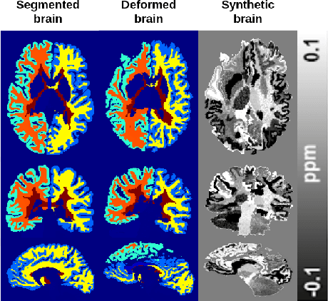 Figure 3 for NeXtQSM -- A complete deep learning pipeline for data-consistent quantitative susceptibility mapping trained with hybrid data