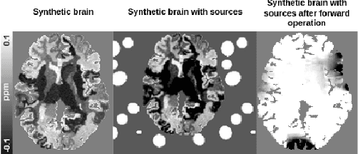 Figure 4 for NeXtQSM -- A complete deep learning pipeline for data-consistent quantitative susceptibility mapping trained with hybrid data