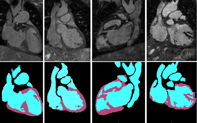 Figure 3 for Automatic 3D Cardiovascular MR Segmentation with Densely-Connected Volumetric ConvNets