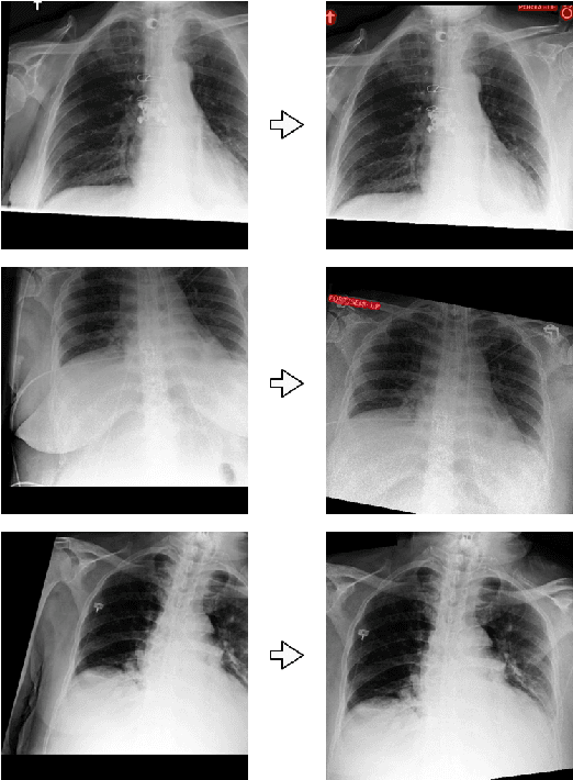 Figure 3 for Y-Net for Chest X-Ray Preprocessing: Simultaneous Classification of Geometry and Segmentation of Annotations