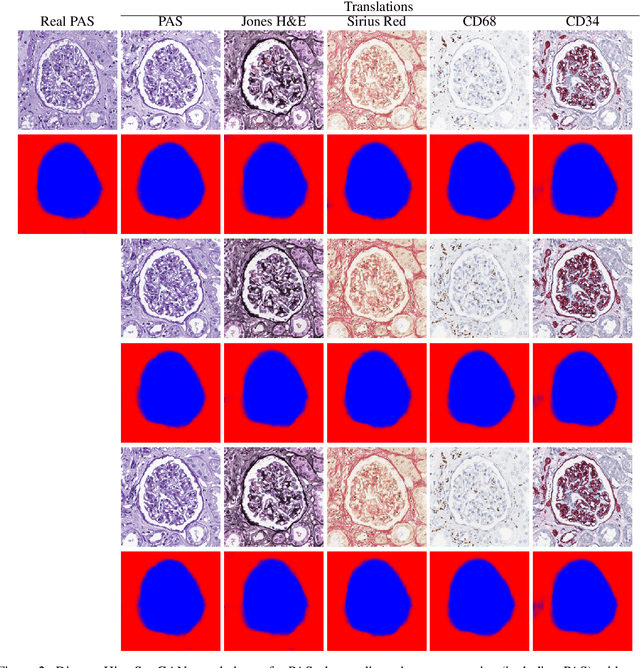 Figure 3 for HistoStarGAN: A Unified Approach to Stain Normalisation, Stain Transfer and Stain Invariant Segmentation in Renal Histopathology
