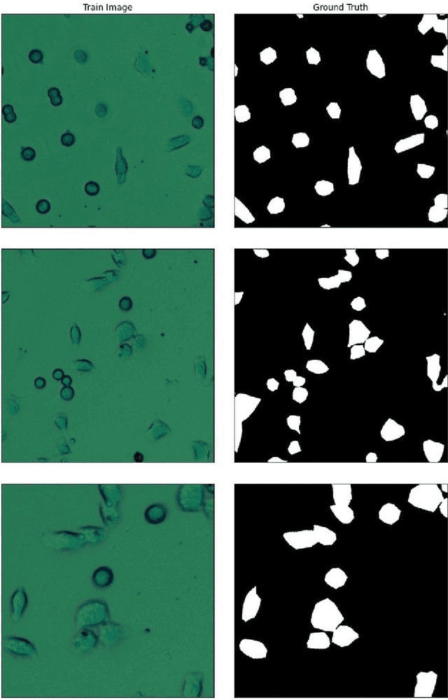 Figure 1 for Cell segmentation from telecentric bright-field transmitted light microscopic images using a Residual Attention U-Net: a case study on HeLa line